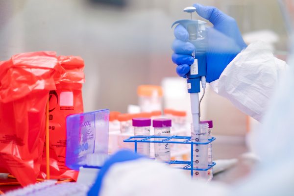 Test valutazione anticorpi Anti SARS 2