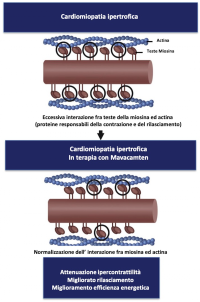 Sarcomero con Mavacamten 